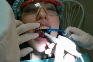 Чистка зубов ультразвуком в стоматологии Рико - крупный план